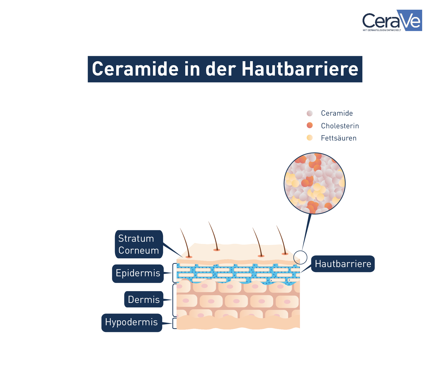 Grafik Ceramide in der Hautbarriere 